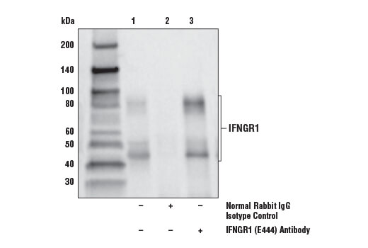 undefined Image 29: MHC Class I Antigen Processing and Presentation Antibody Sampler Kit