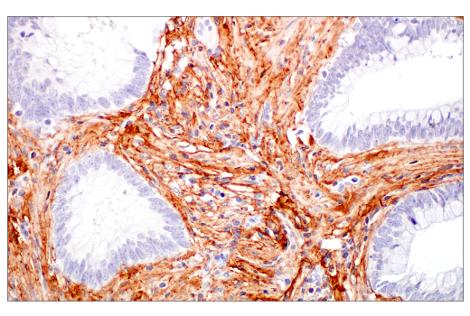 Immunohistochemistry Image 5: COL3A1 (E8D7R) XP<sup>®</sup> Rabbit mAb (BSA and Azide Free)