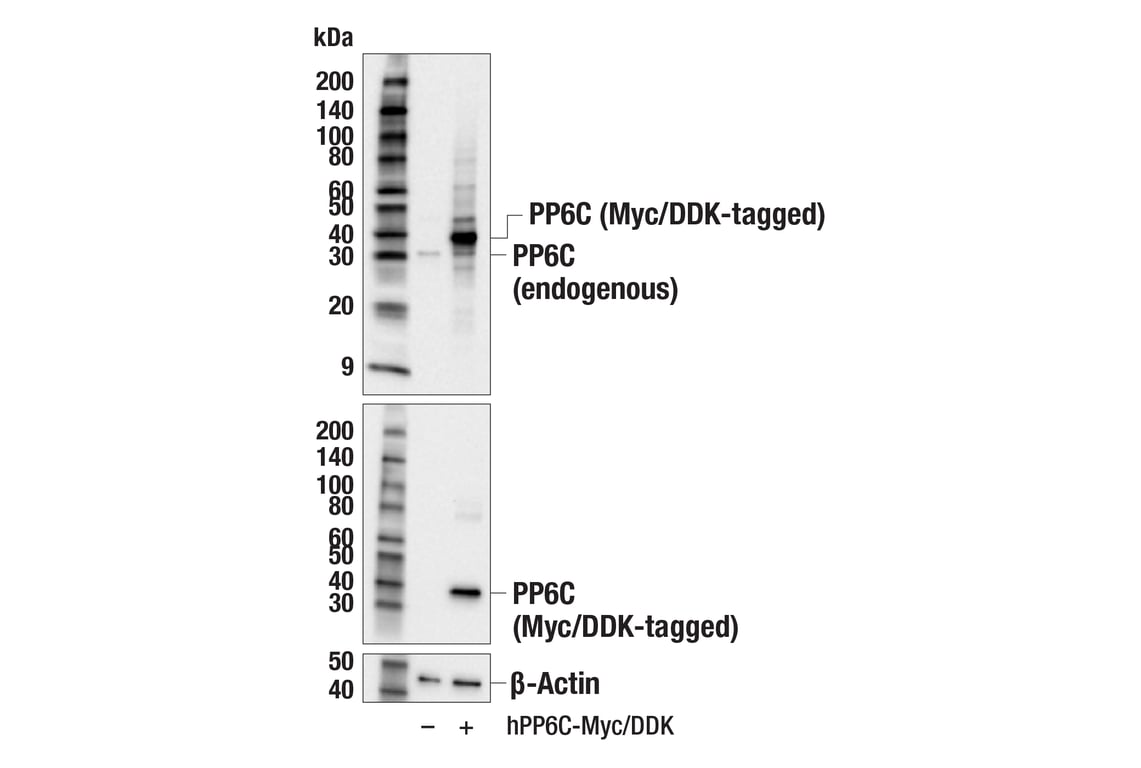Western Blotting Image 2: PP6C (E3V2A) Rabbit mAb