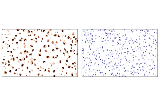 Immunohistochemistry Image 4: Sox10 (E6B6I) XP<sup>®</sup> Rabbit mAb (BSA and Azide Free)