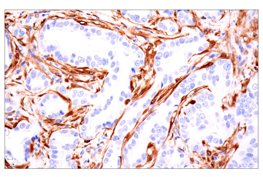 Immunohistochemistry Image 1: NNMT (E6N2Z) XP<sup>®</sup> Rabbit mAb