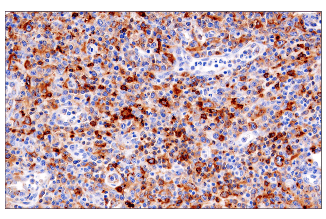 Immunohistochemistry Image 3: HLA-DRA (E9R2Q) XP<sup>®</sup> Rabbit mAb