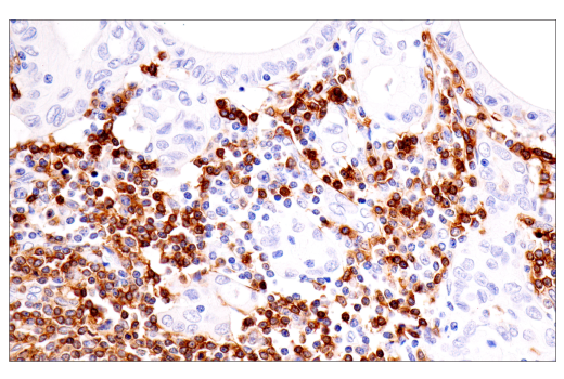 Immunohistochemistry Image 1: TNFRSF13C/BAFF-R (E3C1Q) XP<sup>®</sup> Rabbit mAb (BSA and Azide Free)