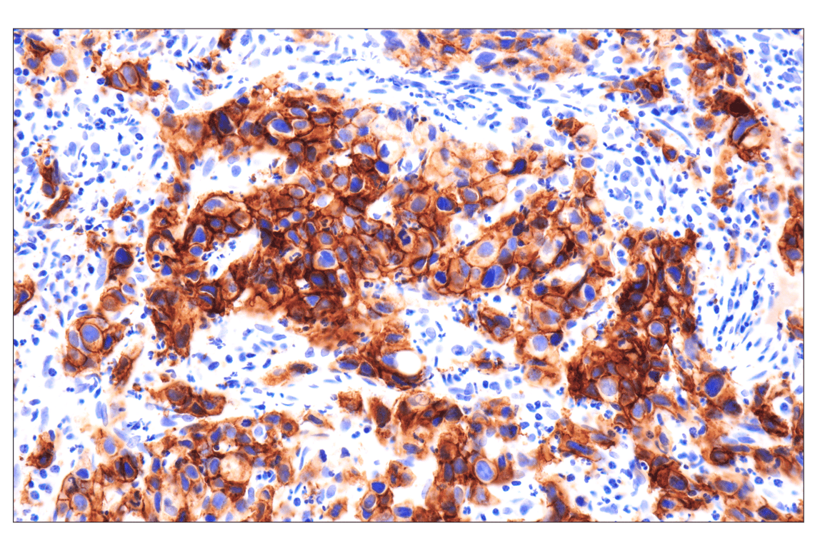 Immunohistochemistry Image 1: FGF Receptor 2 (D4L2V) Rabbit mAb (BSA and Azide Free)