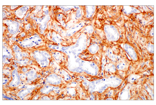 undefined Image 5: Extracellular Matrix Dynamics Antibody Sampler Kit