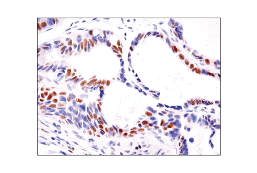 Immunohistochemistry Image 5: HAUSP (D17C6) XP<sup>®</sup> Rabbit mAb