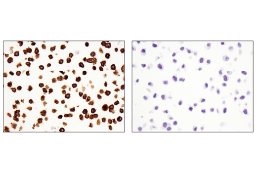 Immunohistochemistry Image 7: TNFRSF8/CD30 (E4L4I) XP<sup>®</sup> Rabbit mAb