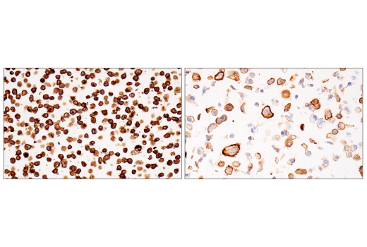 Immunohistochemistry Image 10: CD38 (E7Z8C) XP<sup>®</sup> Rabbit mAb (BSA and Azide Free)