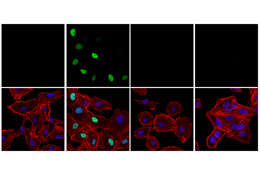 undefined Image 7: PhosphoPlus<sup>®</sup> p53 (Ser15) Antibody Duet