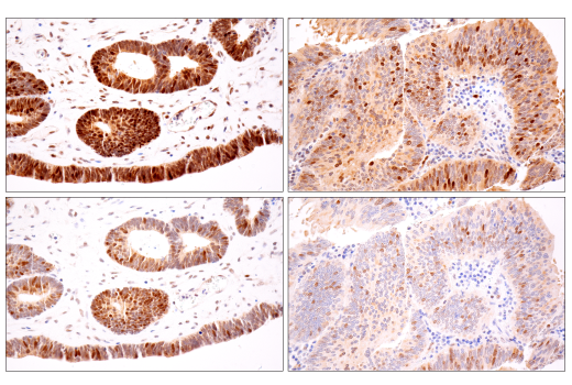 Immunohistochemistry Image 2: CDK2 (E8J9T) XP<sup>®</sup> Rabbit mAb (BSA and Azide Free)