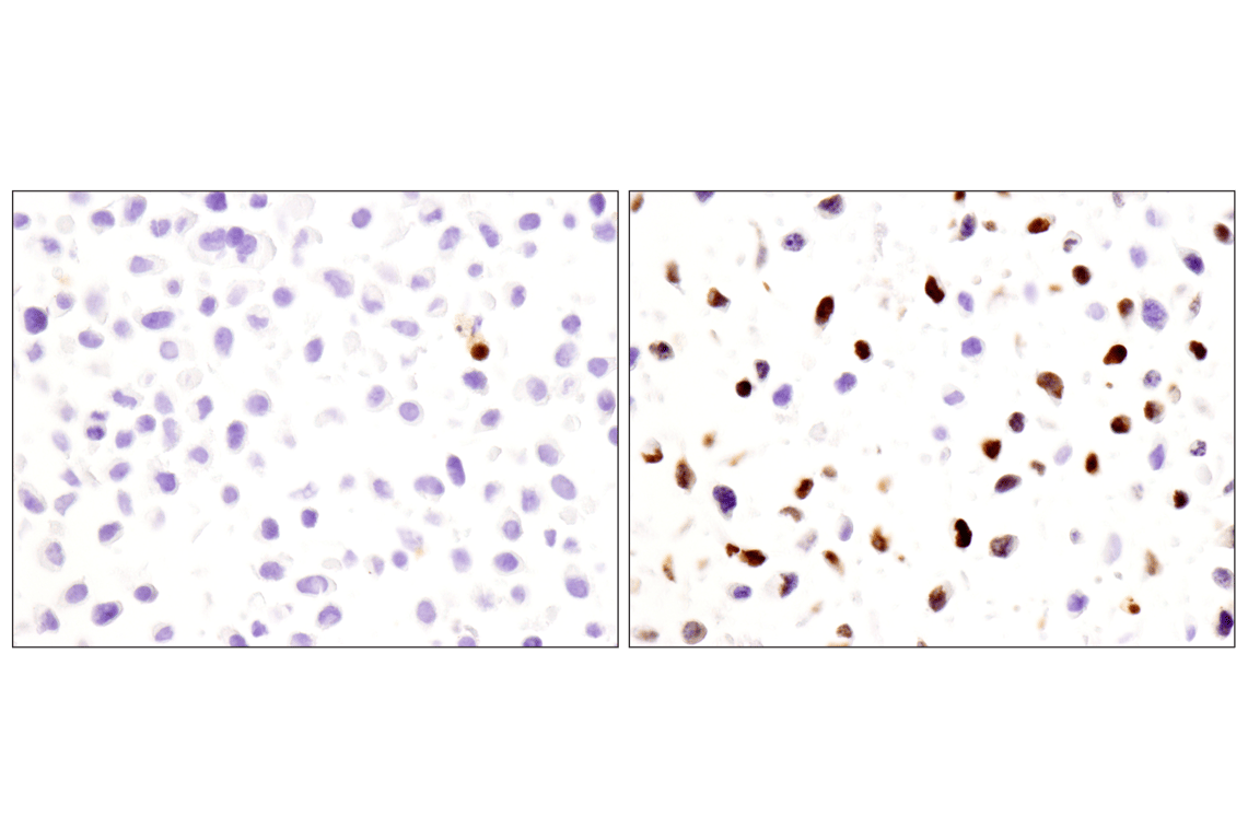 undefined Image 22: Apoptosis Antibody Sampler Kit II