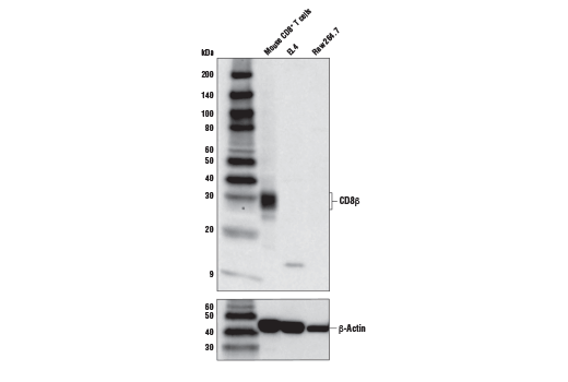 Western Blotting Image 1: CD8β (D7C8H) Rabbit mAb