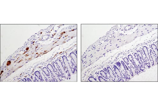 undefined Image 40: LRP1-mediated Endocytosis and Transmission of Tau Antibody Sampler Kit