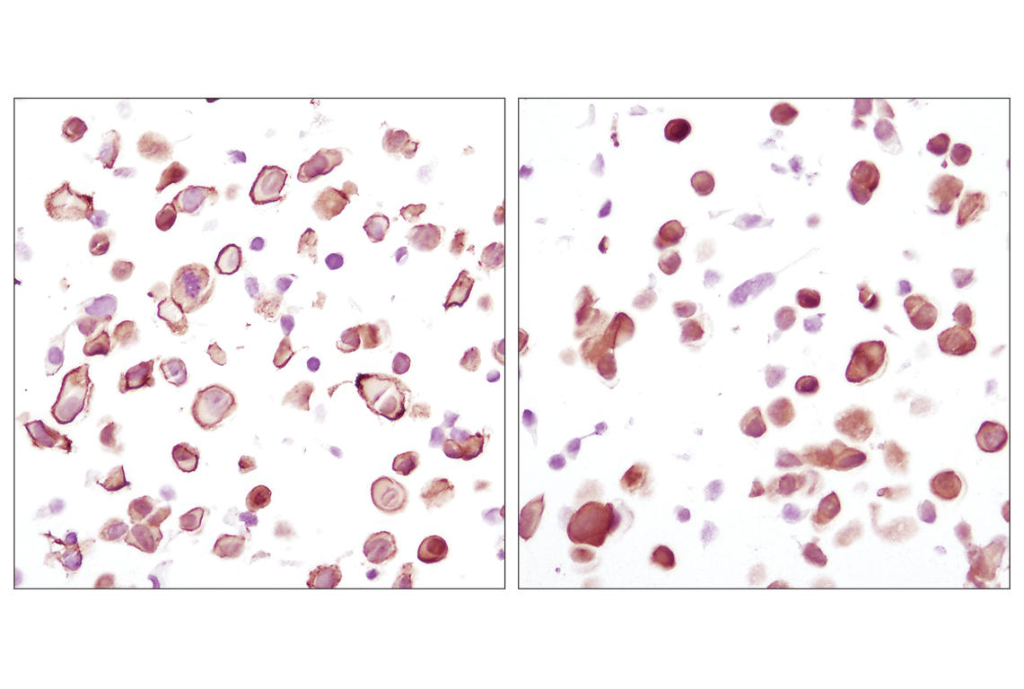 Immunohistochemistry Image 3: Akt (pan) (C67E7) Rabbit mAb