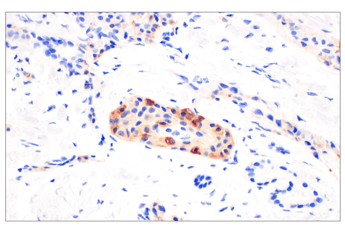 Immunohistochemistry Image 2: CHGA (F7D6H) Rabbit mAb