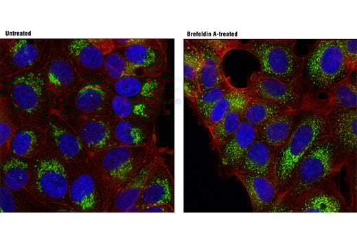 undefined Image 18: Organelle Localization IF Antibody Sampler Kit