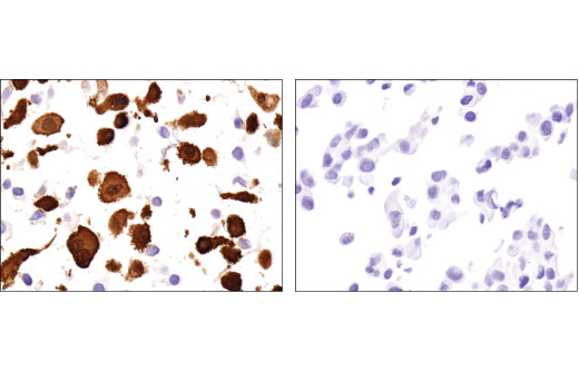 undefined Image 35: Microglia Neurodegeneration Module Antibody Sampler Kit