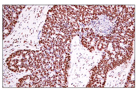 Immunohistochemistry Image 4: ADAR1 (E6X9R) XP<sup>®</sup> Rabbit mAb