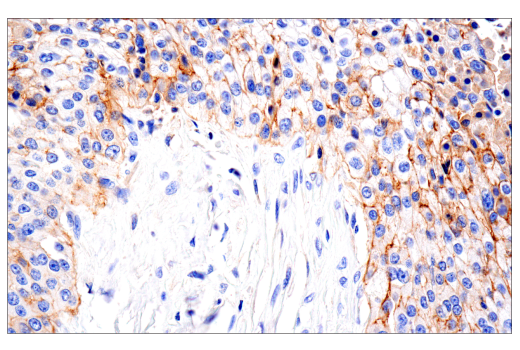 Immunohistochemistry Image 4: NG2/CSPG4 (E3B3G) XP<sup>®</sup> Rabbit mAb (BSA and Azide Free)