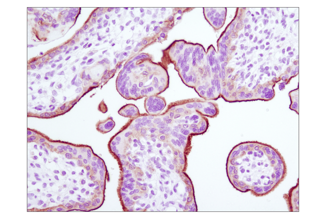 undefined Image 53: Lung Cancer RTK Antibody Sampler Kit