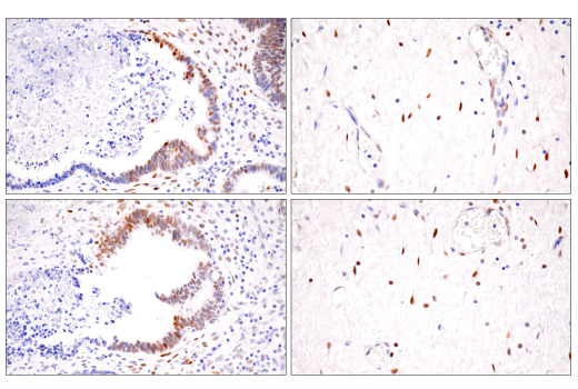 Immunohistochemistry Image 7: HIF-1α (E1V6A) Rabbit mAb
