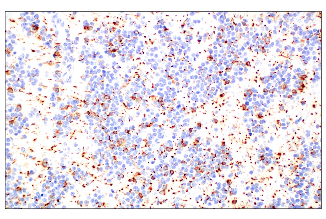 Immunohistochemistry Image 1: Doublecortin (E3S7L) Rabbit mAb (BSA and Azide Free)