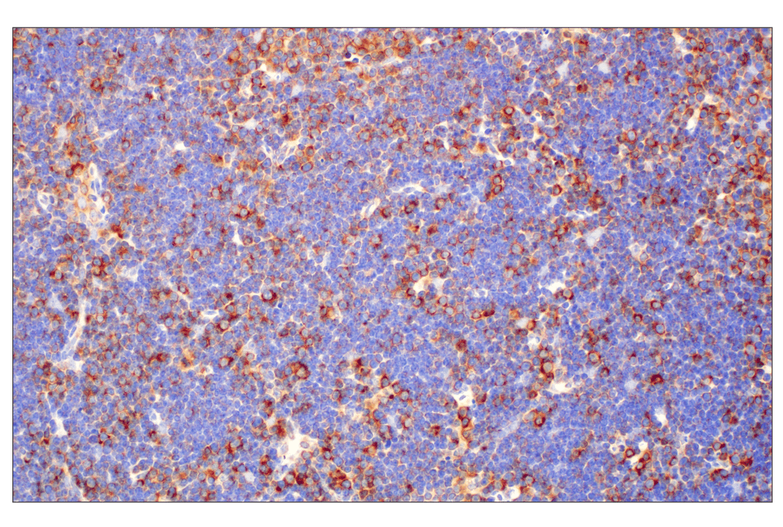Immunohistochemistry Image 10: RACK1 (D59D5) Rabbit mAb