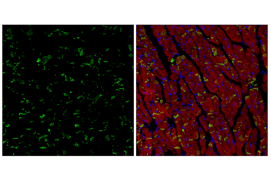 Immunofluorescence Image 3: N-Cadherin (D4R1H) XP<sup>®</sup> Rabbit mAb