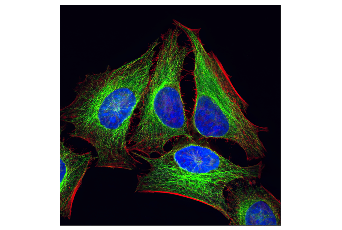 Immunofluorescence Image 1: α-Tubulin (11H10) Rabbit mAb