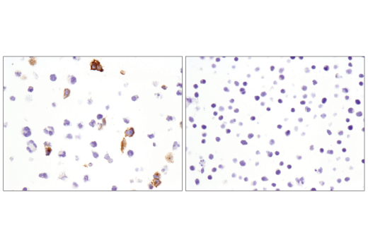 Immunohistochemistry Image 7: OX40 (E9U7O) XP<sup>®</sup> Rabbit mAb (BSA and Azide Free)