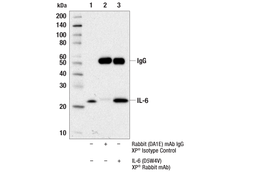 Immunoprecipitation Image 1: IL-6 (D5W4V) XP<sup>®</sup> Rabbit mAb