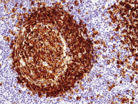 使用 CD19 (Intracellular Domain) (D4V4B) XP<sup>®</sup> Rabbit mAb 对石蜡包埋的人扁桃体细胞进行免疫组织化学分析。