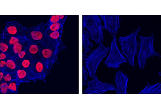 Immunofluorescence Image 1: Sox2 (D6D9) XP<sup>®</sup> Rabbit mAb (Alexa Fluor<sup>®</sup> 555 Conjugate)