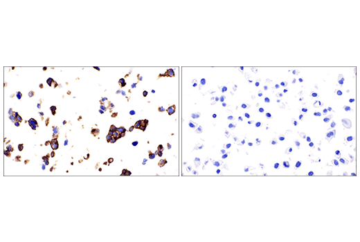 Immunohistochemistry Image 2: VE-Cadherin (E6N7A) Rabbit mAb (BSA and Azide Free)