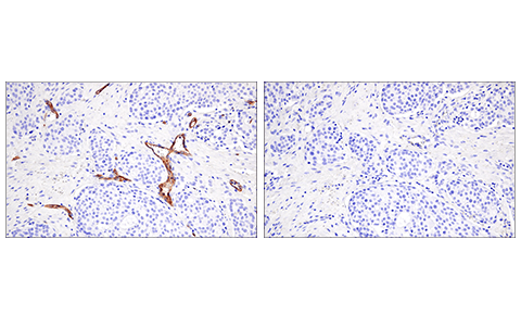 Immunohistochemistry Image 4: CD200 (E5I9V) XP<sup>®</sup> Rabbit mAb (BSA and Azide Free)