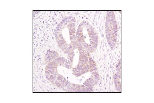 Immunohistochemistry Image 3: Acetyl-CoA Carboxylase (C83B10) Rabbit mAb (BSA and Azide Free)