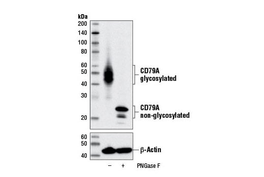 undefined Image 13: B Cell Signaling Antibody Sampler Kit II