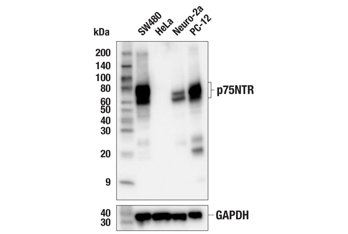 Western Blotting Image 1: p75NTR (F2L9S) Rabbit mAb (BSA and Azide Free)