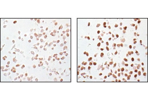 undefined Image 61: Cannabinoid Receptor 1 Downstream Signaling Antibody Sampler Kit