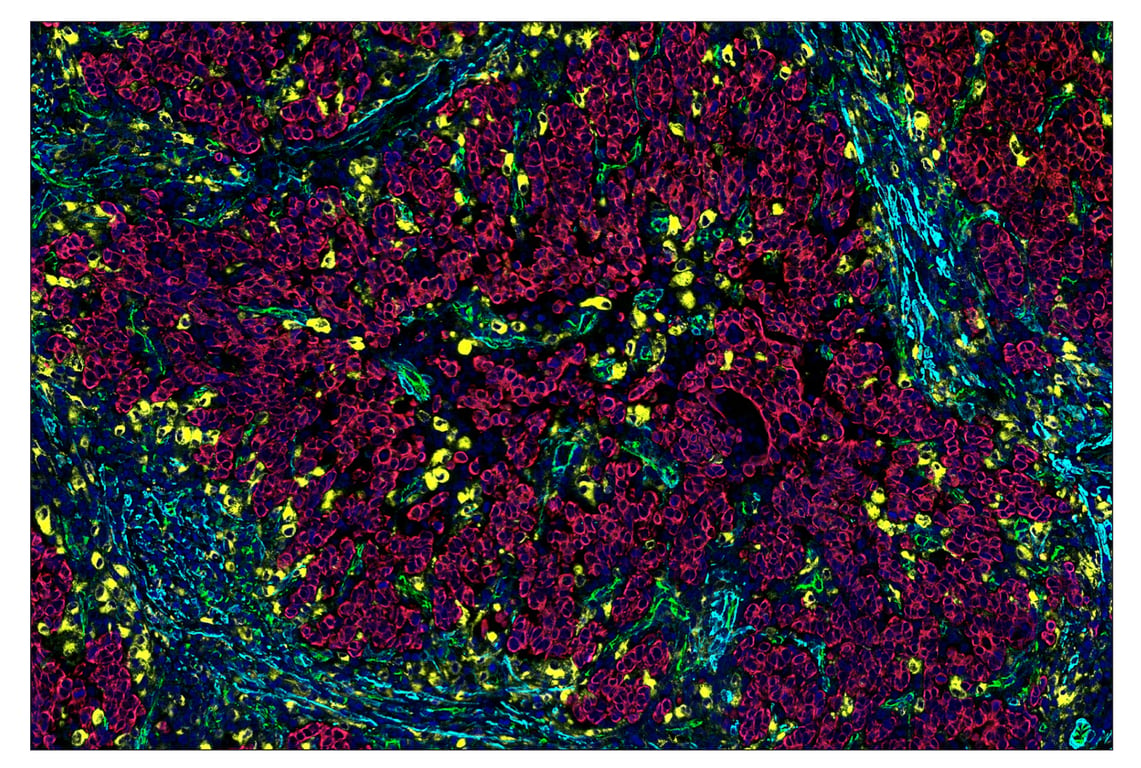 Immunohistochemistry Image 1: α-Smooth Muscle Actin (D4K9N) & CO-0024-750 SignalStar<sup>™</sup> Oligo-Antibody Pair