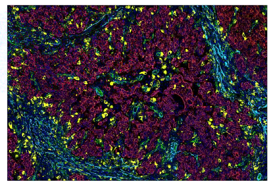 Immunohistochemistry Image 1: α-Smooth Muscle Actin (D4K9N) & CO-0024-647 SignalStar™ Oligo-Antibody Pair