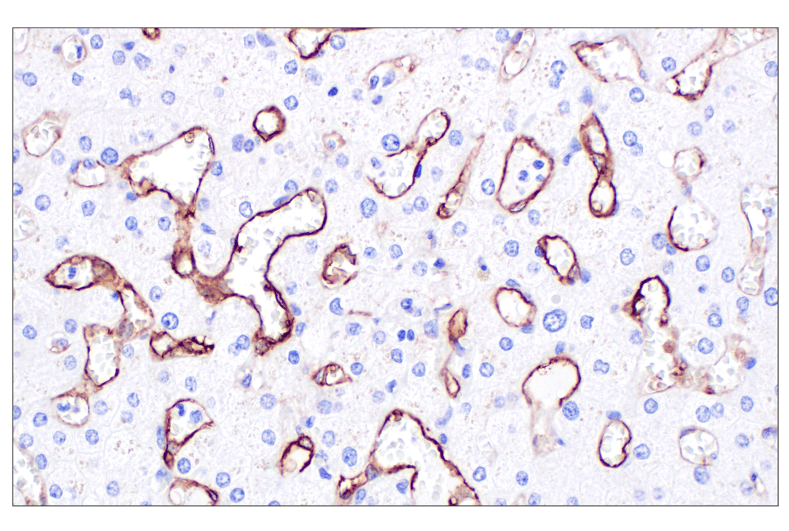 Immunohistochemistry Image 7: CD105/Endoglin (F9C5Q) Rabbit mAb