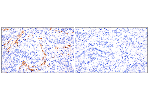 Immunohistochemistry Image 3: VE-Cadherin (E6N7A) Rabbit mAb (BSA and Azide Free)