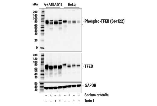 Western Blotting Image 2: Phospho-TFEB (Ser122) (E9M5M) Rabbit mAb