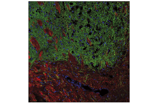 Immunofluorescence Image 1: Tyrosine Hydroxylase (E2L6M) Rabbit mAb (BSA and Azide Free)