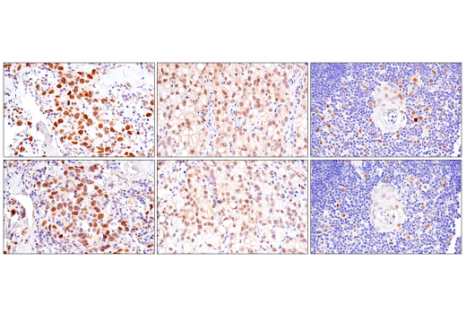 Immunohistochemistry Image 9: Bcl-3 (E4D4K) Rabbit mAb