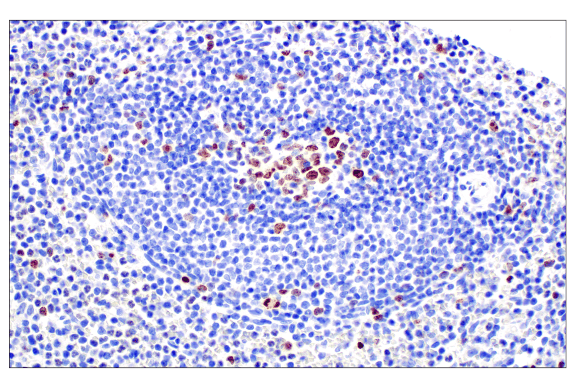 Immunohistochemistry Image 4: Ki-67 (D2H10) Rabbit mAb (BSA and Azide Free)
