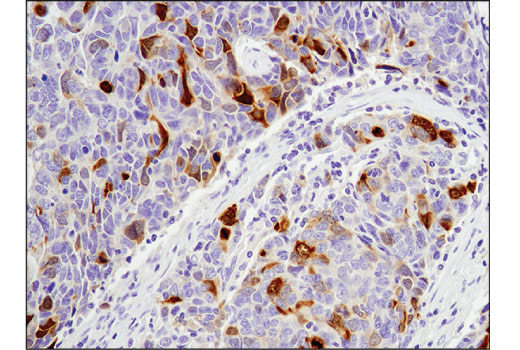 Immunohistochemistry Image 2: Aurora A (D3V7T) XP<sup>®</sup> Rabbit mAb (BSA and Azide Free)