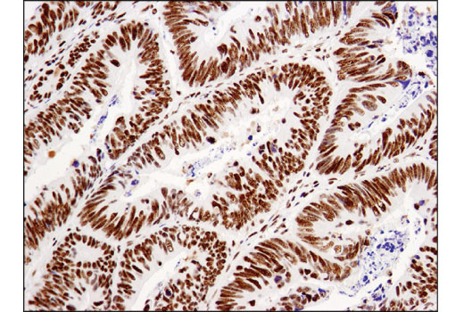 undefined Image 31: BAF Complex IHC Antibody Sampler Kit