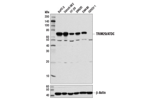 Western Blotting Image 1: TRIM29/ATDC (E1L4E) Rabbit mAb